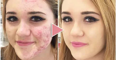 2x1 Flower Secret® Base Premium