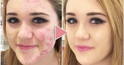 2x1 Flower Secret® Base Premium